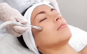 Microdermabrasion